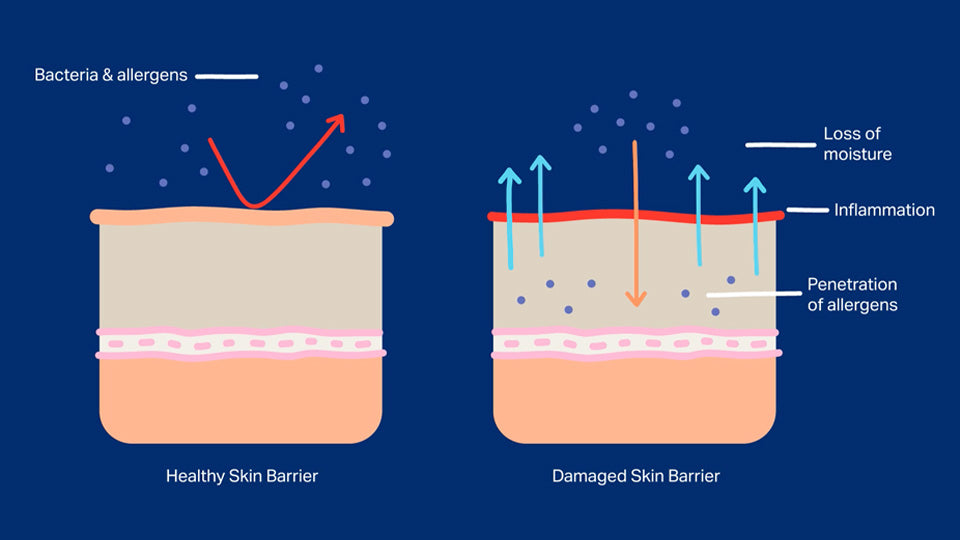 Understanding Skin Barrier Repair: Causes, Signs, & Repair Strategies