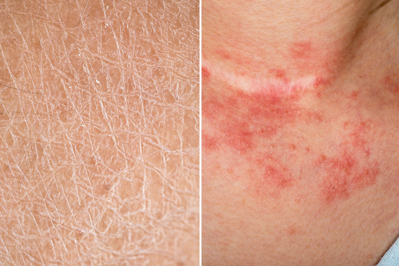 Hydration for Dry Skin: Humectants, Occlusives & Emollients Explained