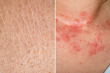 Hydration for Dry Skin: Humectants, Occlusives & Emollients Explained