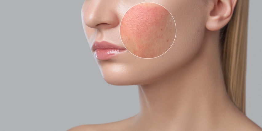 Why ‘Inflammaging’ Matters: How Inflammation Accelerates Skin Aging & Natural Ways to Calm It