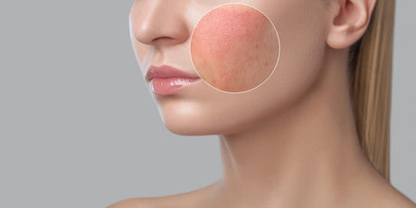 Why ‘Inflammaging’ Matters: How Inflammation Accelerates Skin Aging & Natural Ways to Calm It