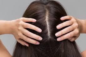 Scalp Health & Hairline Acne: Treatments for Muslim Women Who Cover Their Hair